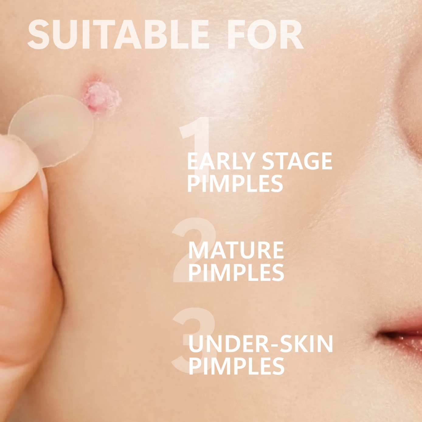 Micro Needle Pimple Patch (24  - Face Moisturizer 评论和价格